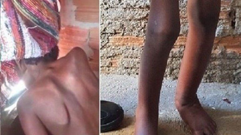 Hallan a un nene desnudo y desnutrido en un barril