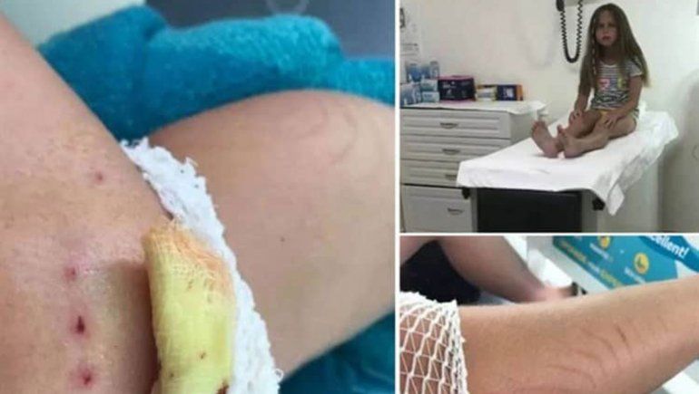 Cancún: una nena fue atacada por dos delfines