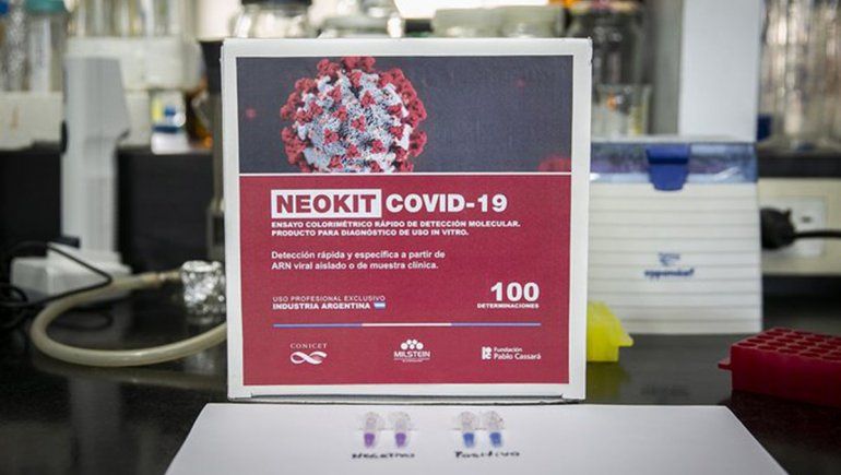 Cómo funciona el NeoKit Covid-19 desarrollado por científicos argentinos