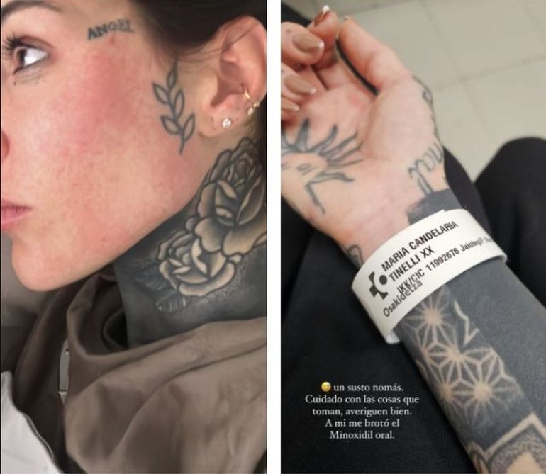 A principios de abril Cande debió ser hospitalizada en Barcelona por un severo cuadro de alergia.