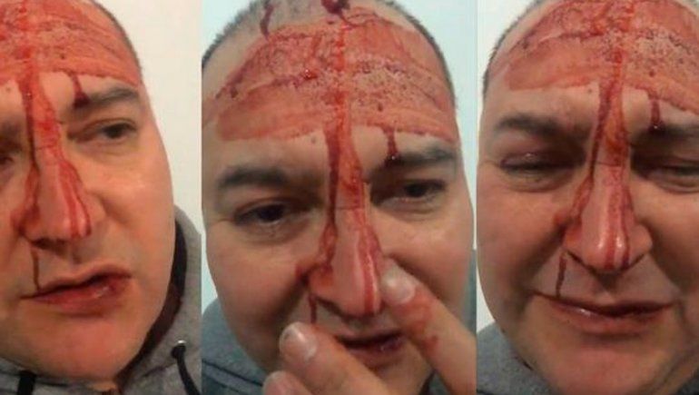 ¿Leo García mintió? Difundieron el video completo de la agresión