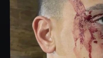 un jugador de boca sufrio un violento asalto al regresar de parana un jugador de boca sufrio un violento asalto al regresar de parana