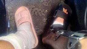 El derrumbe de un acantilado en Mari Menuco le provocó graves daños en sus piernas | LM Neuquen El derrumbe de un acantilado en Mari Menuco le provocó graves daños en sus piernas