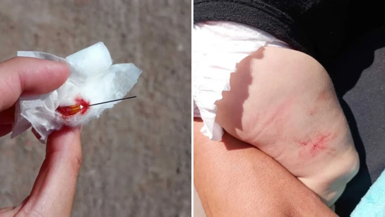 Un peligro: fue a vacunar a su bebé y le dejaron una aguja en la pierna