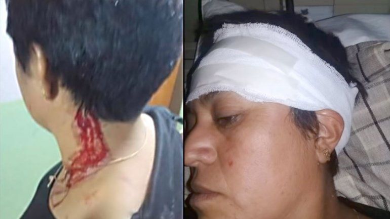 Su ex pareja la atacó a ladrillazos y piñas en la calle