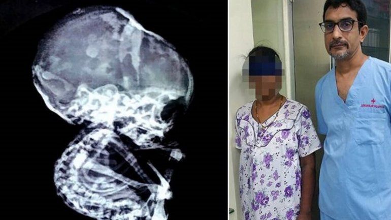 Cuando la operaron por una obstrucción