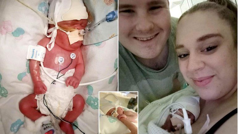 El bebé de los milagros: lo revivieron y pasó el COVID