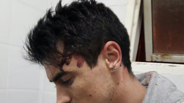 Adrián con la cabeza sangrando tras ser atacado por los estafadores.