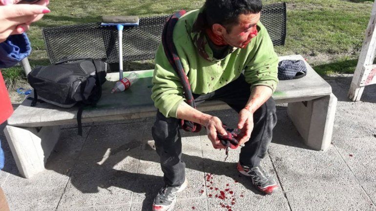 Brutal pelea entre limpiavidrios terminó con uno desmayado y casi atropellado