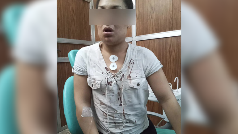 La víctima tiene fracturado el maxilar y será sometida a una operación. La víctima tiene fracturado el maxilar y será sometida a una operación.