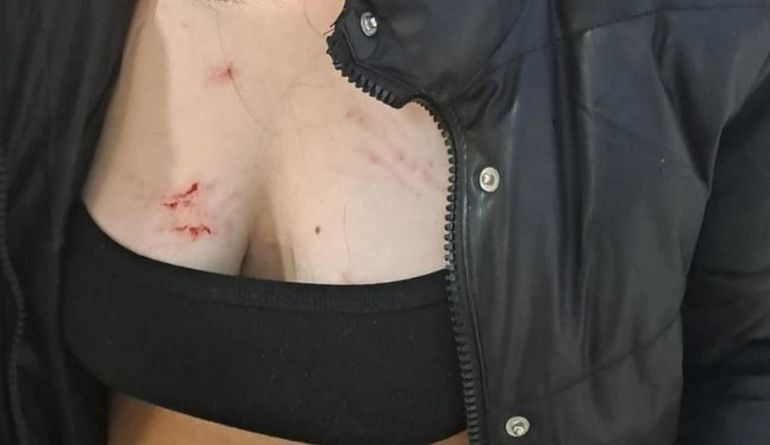 Río Gallegos: una amiga de la chica quiso intervenir y también fue agredida. Río Gallegos: una amiga de la chica quiso intervenir y también fue agredida.