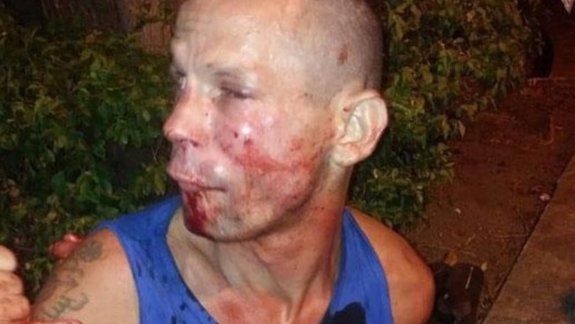 Quiso robarle el celular a luchadora de UFC y terminó en el hospital