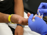 Hepatitis C: por qué es importante testearse al menos una vez en la vida