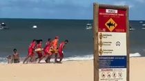 Tiburones al acecho en Brasil: un niño y una joven fueron atacados y sufrieron amputaciones Tiburones al acecho en Brasil: un niño y una joven fueron atacados y sufrieron amputaciones