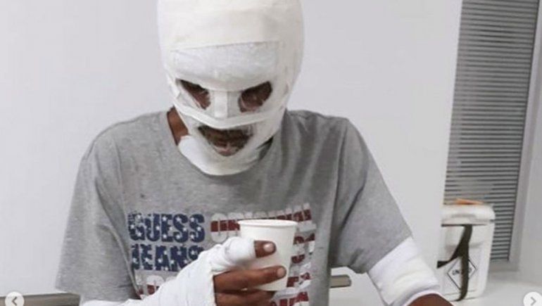 Por salvar a ocho perritos, casi muere calcinado