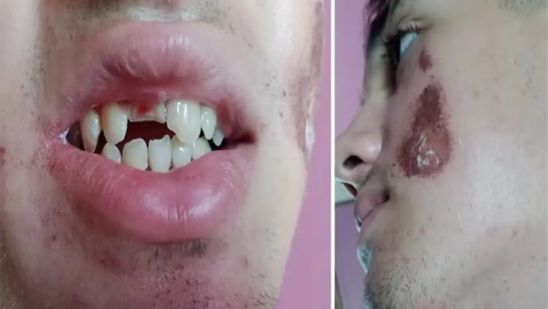 Esperaba el remis a la salida del boliche y recibió una brutal golpiza