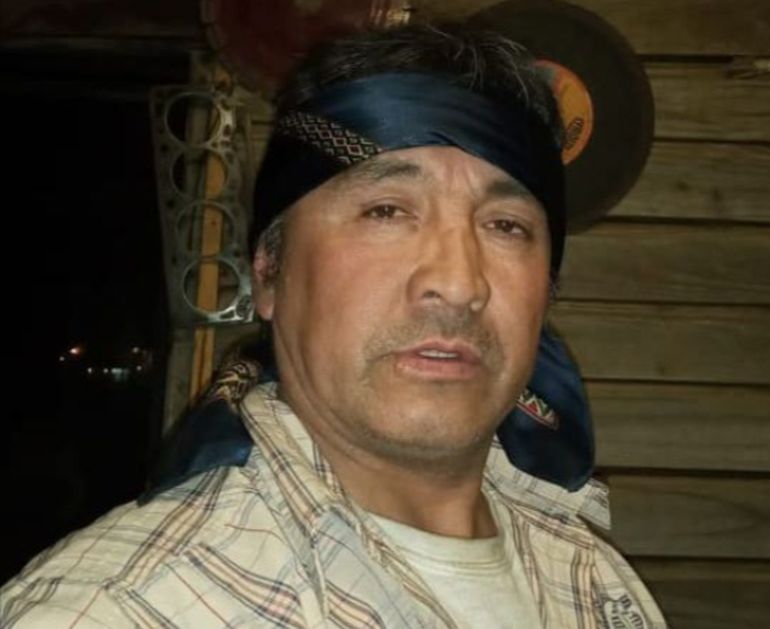 Mario Vargas sufrió graves quemaduras en las vías respiratorias y las cuerdas vocales, y está en terapia intensiva en Río Gallegos. Mario Vargas sufrió graves quemaduras en las vías respiratorias y las cuerdas vocales, y está en terapia intensiva en Río Gallegos.