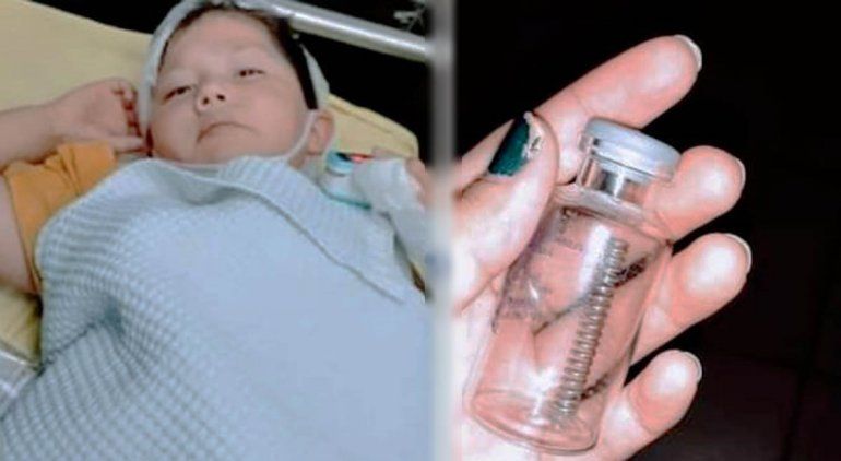 El nene que se tragó un resorte de metal salió bien de la operación