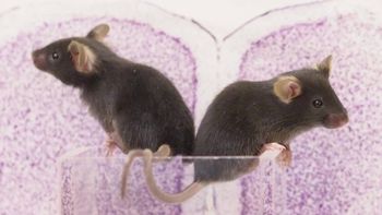 Ratas en el inodoro: ¿leyenda urbana o algo que realmente puede pasar? Ratas en el inodoro: ¿leyenda urbana o algo que realmente puede pasar?