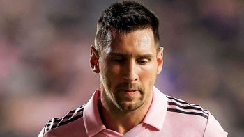 La lesión de Lionel Messi preocupa cada vez más. La lesión de Lionel Messi preocupa cada vez más.