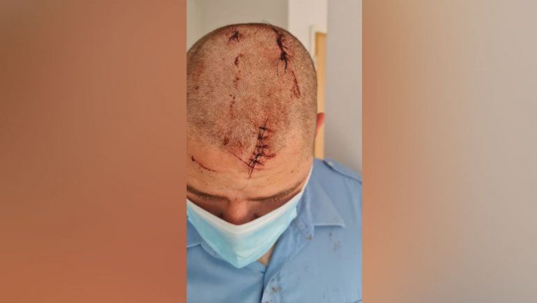 Brutal golpiza a efectivo policial neuquino en plena calle