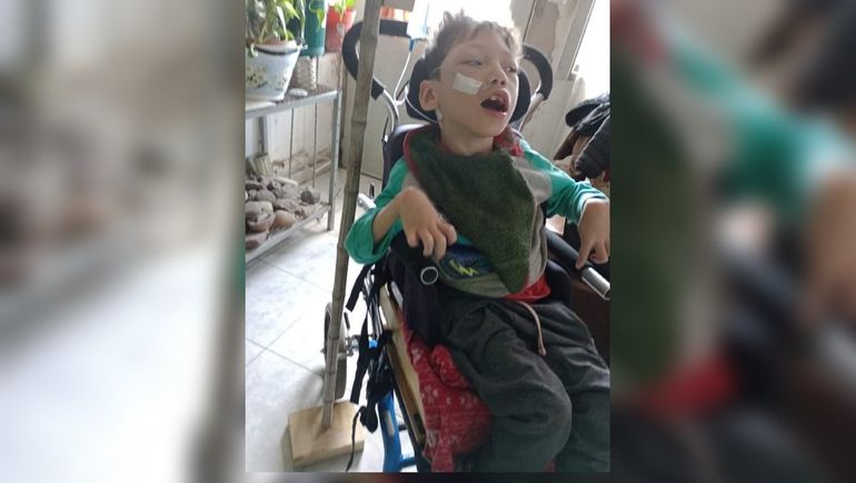 Santino consiguió el dinero para seguir con las terapias