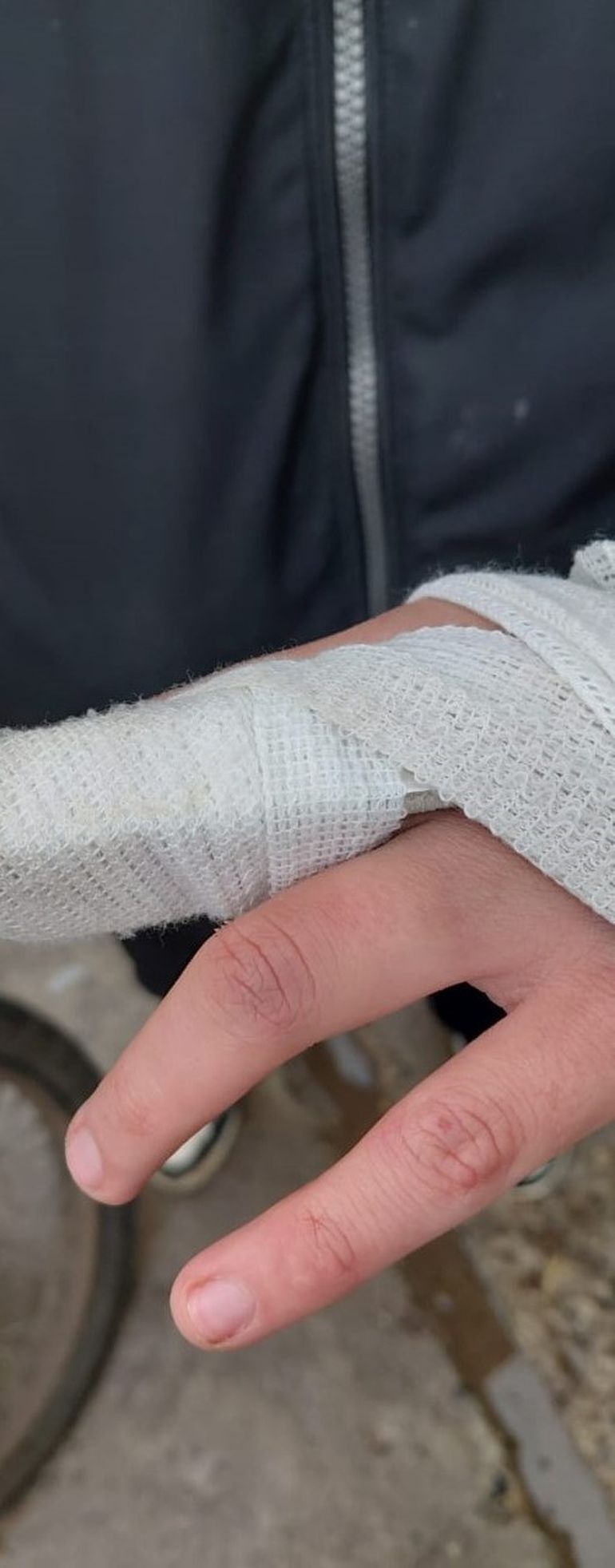 Fernanda sufrió una lesión en un dedo cuando E.J.C le dobló la mano. 
