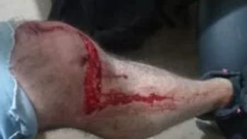 Comodoro Rivadavia: dos dogos lo atacaron en la calle. Comodoro Rivadavia: dos dogos lo atacaron en la calle.