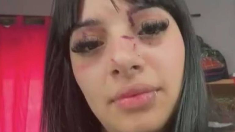 Las heridas en su rostro luego del ataque. 