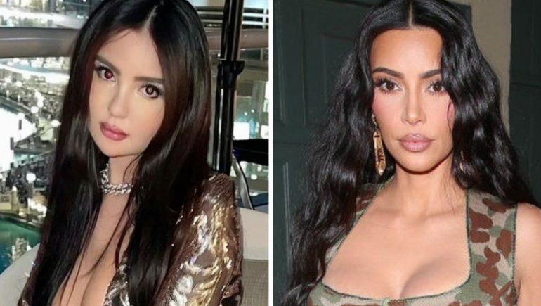 Instagram: gastó miles de dólares para parecerse a Kim Kardashian y se arrepintió.