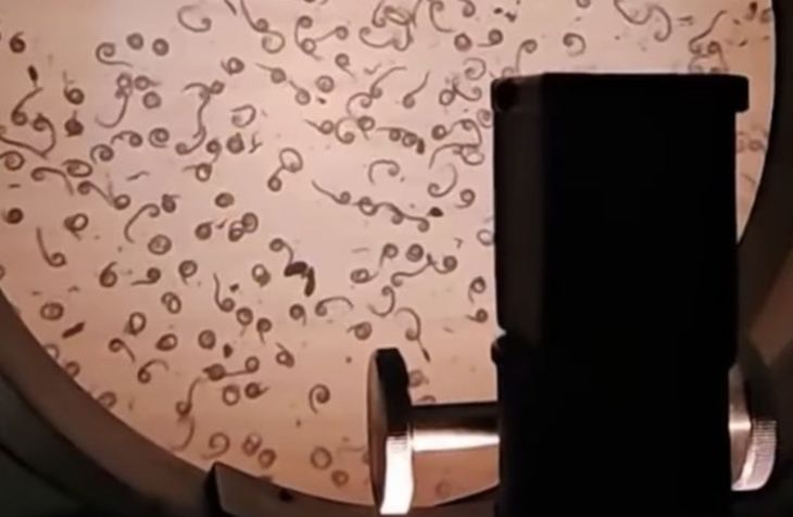 Así se ven en un microscopio las larvas de Trichinella. Fuente: Senasa