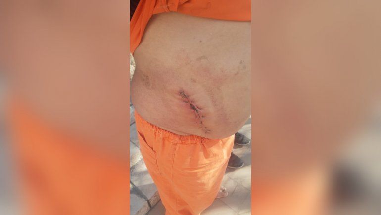 El hombre vive en situación de calle y fue herido por la Policía. Familiares quieren saber qué ocurrió y que les den un parte médico.&nbsp;