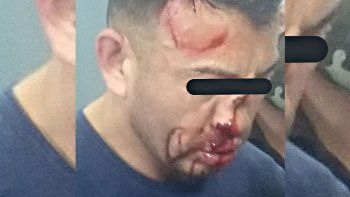 el fisicoculturista femicida recibio una brutal paliza el fisicoculturista femicida recibio una brutal paliza