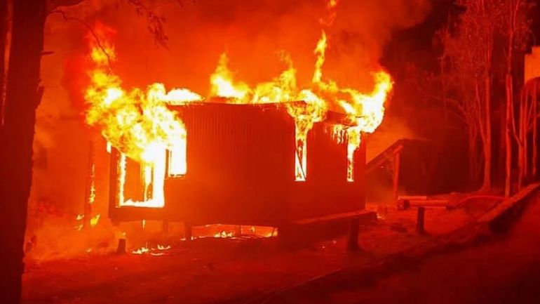 Un nene tiró alcohol en una salamandra y se quemó 50% del cuerpo