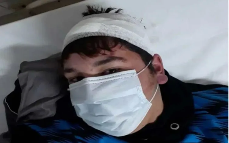 Abuso policial: un nuevo policía fue condenado por herir a un joven durante una detención