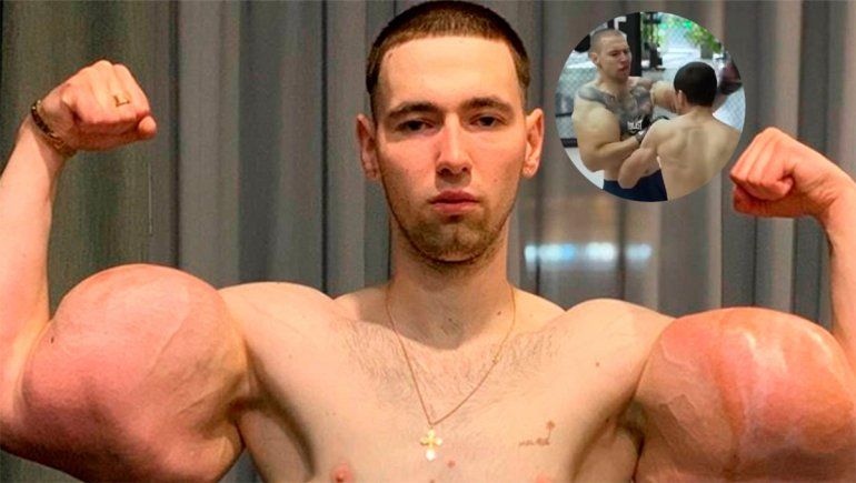 Imágenes sensibles: al Popeye Ruso se le explotó el brazo en medio de una pelea