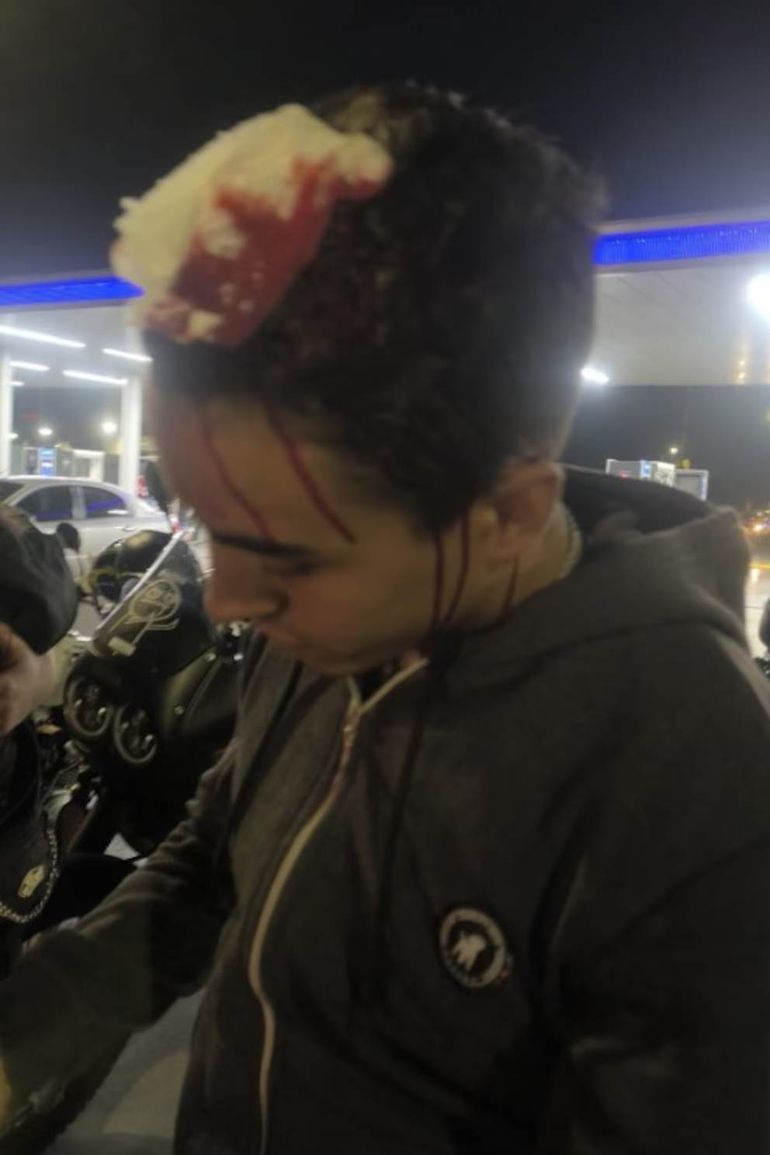 Así quedó el joven atacado por el policía. Así quedó el joven atacado por el policía.