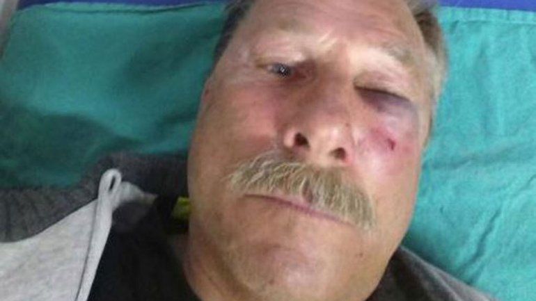 Carlos Prío sufrió importantes golpes en el rostro por el ataque.