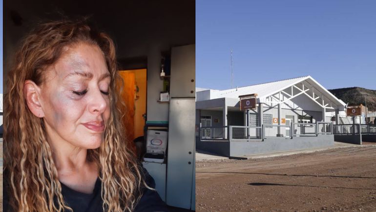 Violencia en un Hospital neuquino: agredieron a una médica durante una emergencia y exigen seguridad