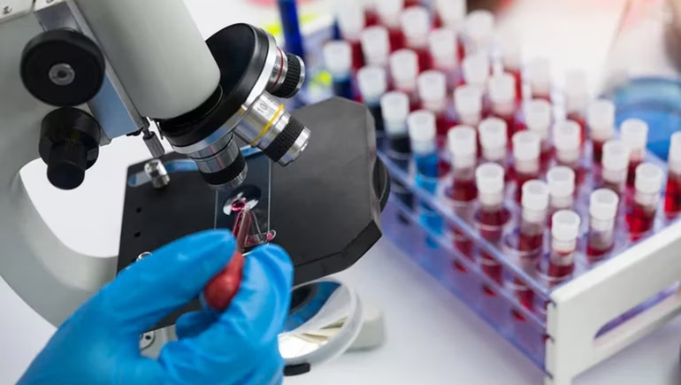 Gran avance argentino en estudio para el virus HIV