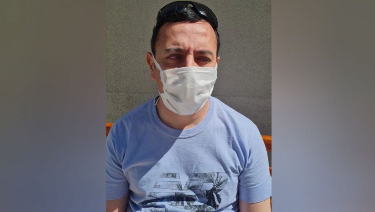 Tuvo COVID, una bacteria dañó sus ojos y necesita operarse