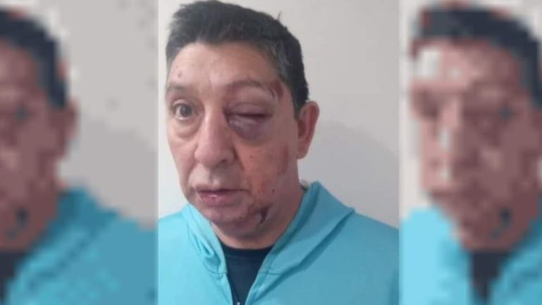 El árbitro Roberto de la Fuente fue salvajemente agredido en un partido del fútbol de veteranos en Comodoro Rivadavia. El árbitro Roberto de la Fuente fue salvajemente agredido en un partido del fútbol de veteranos en Comodoro Rivadavia.