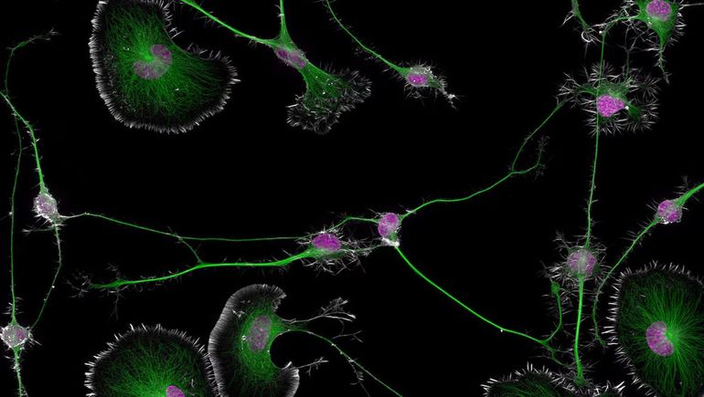 Unas de las imágenes premiadas. Unas de las imágenes premiadas.