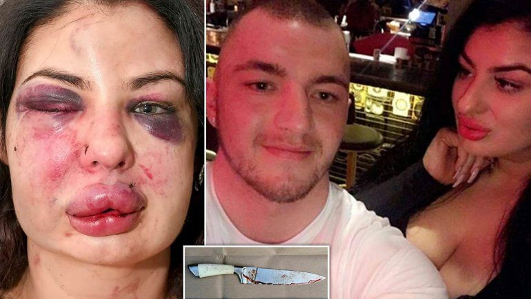 La Policía evitó que un hombre matara a su novia