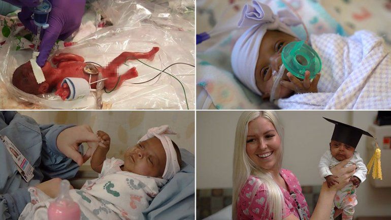 Le dieron el alta a la beba más pequeña del mundo