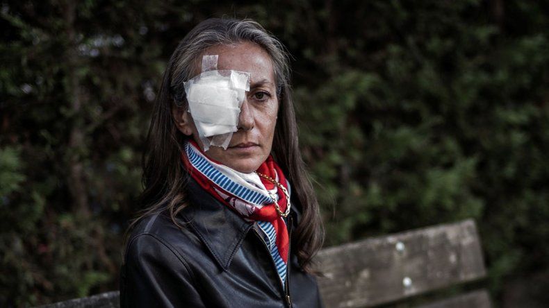 Corine Remande recibió el impacto de la pelota que viajaba a una velocidad de 240 km/h. Se quejó por la falta de atención en el lugar.