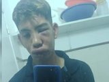 Salvaje golpiza a un joven tras una discusión de tránsito