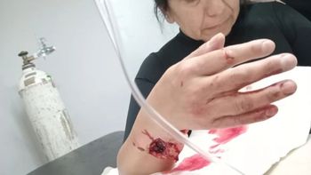 Una vecina de Río Gallegos, gravemente herida por un pitbull. Una vecina de Río Gallegos, gravemente herida por un pitbull.