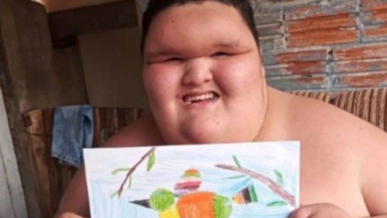 El drama del niño que pesa 200 kilos y tiene 10 años