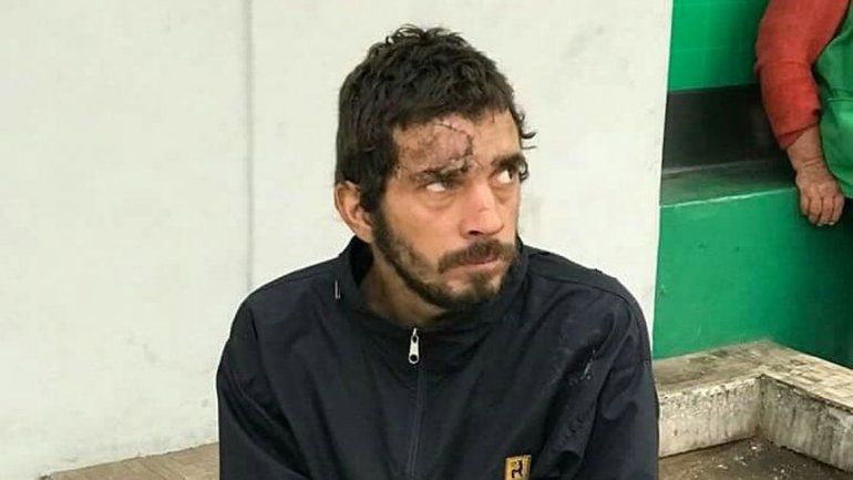 Ariel Alberto Nacer vive en situación de calle en el país inca y tiene una enorme cicatriz en su frente. Las autoridades buscan reconstruir su historia.